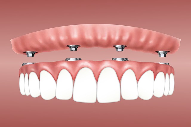 zubní implantát